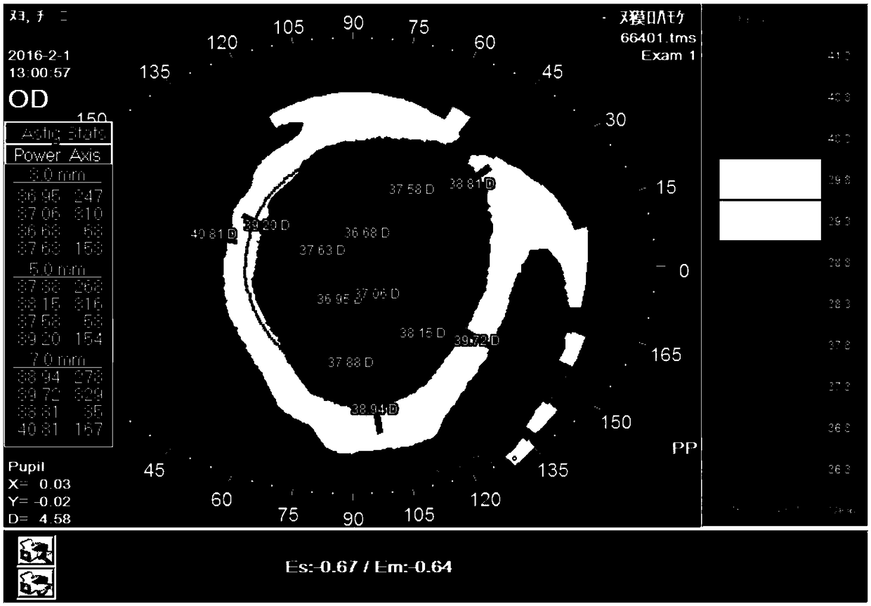Orthokeratology glasses with ultra-high or ultra-low cornea K value and designing method thereof
