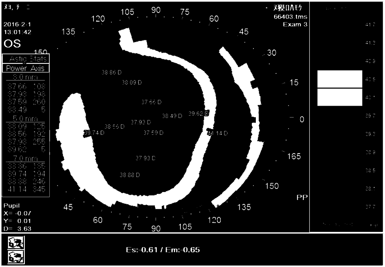 Orthokeratology glasses with ultra-high or ultra-low cornea K value and designing method thereof