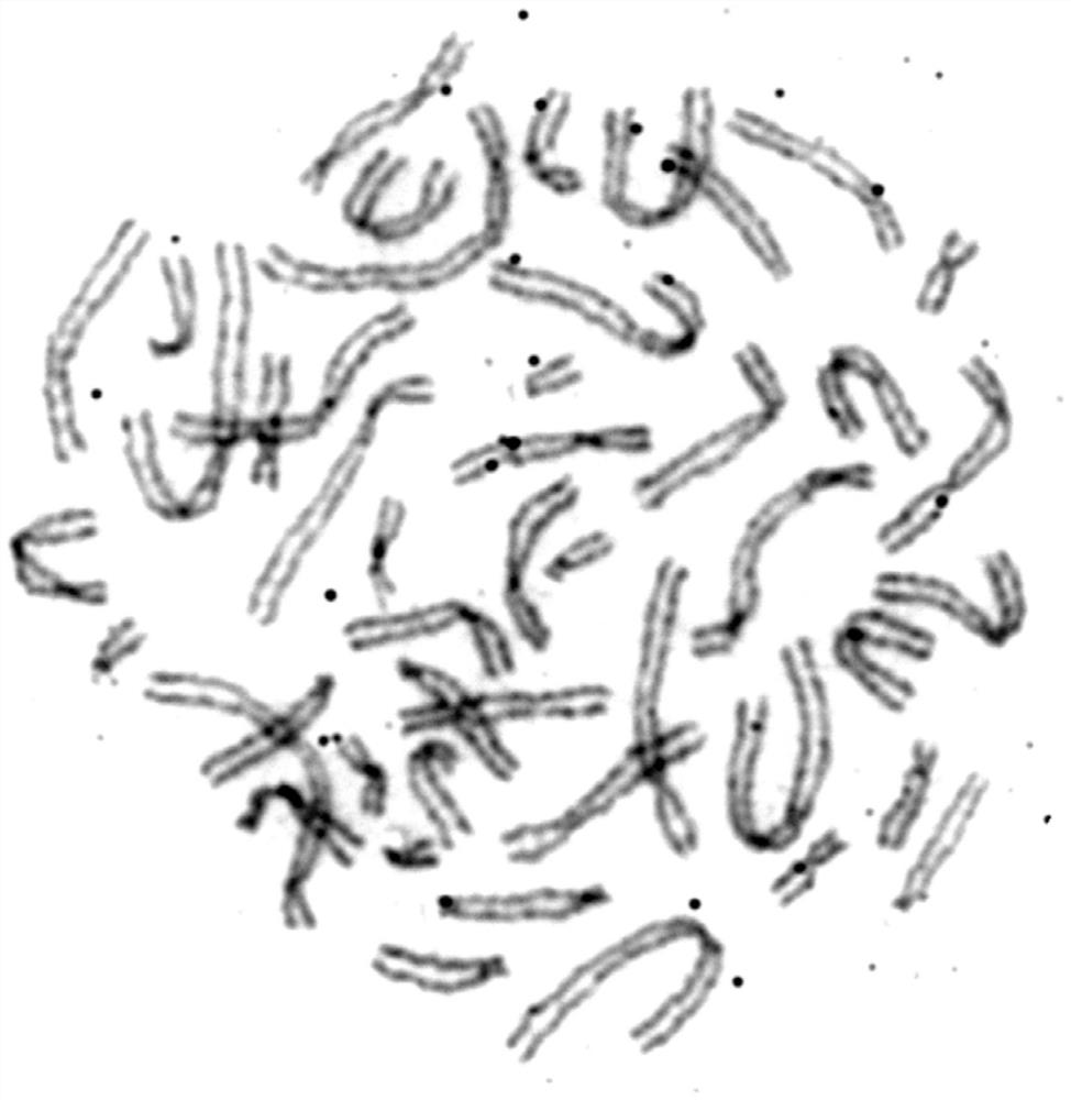 Special preparation of high-resolution chromosome staining solution for karyotype analysis