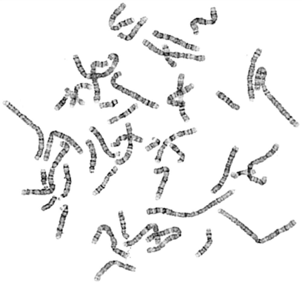 Special preparation of high-resolution chromosome staining solution for karyotype analysis