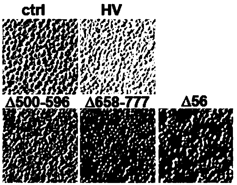 Recombinant PRRS virus HV-NSP2 (500-596) and application thereof