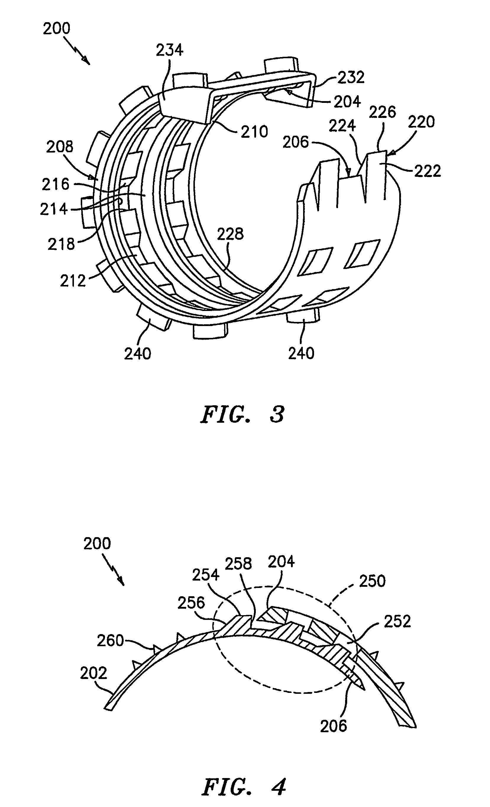 Method and apparatus for anastomosis including annular joining member