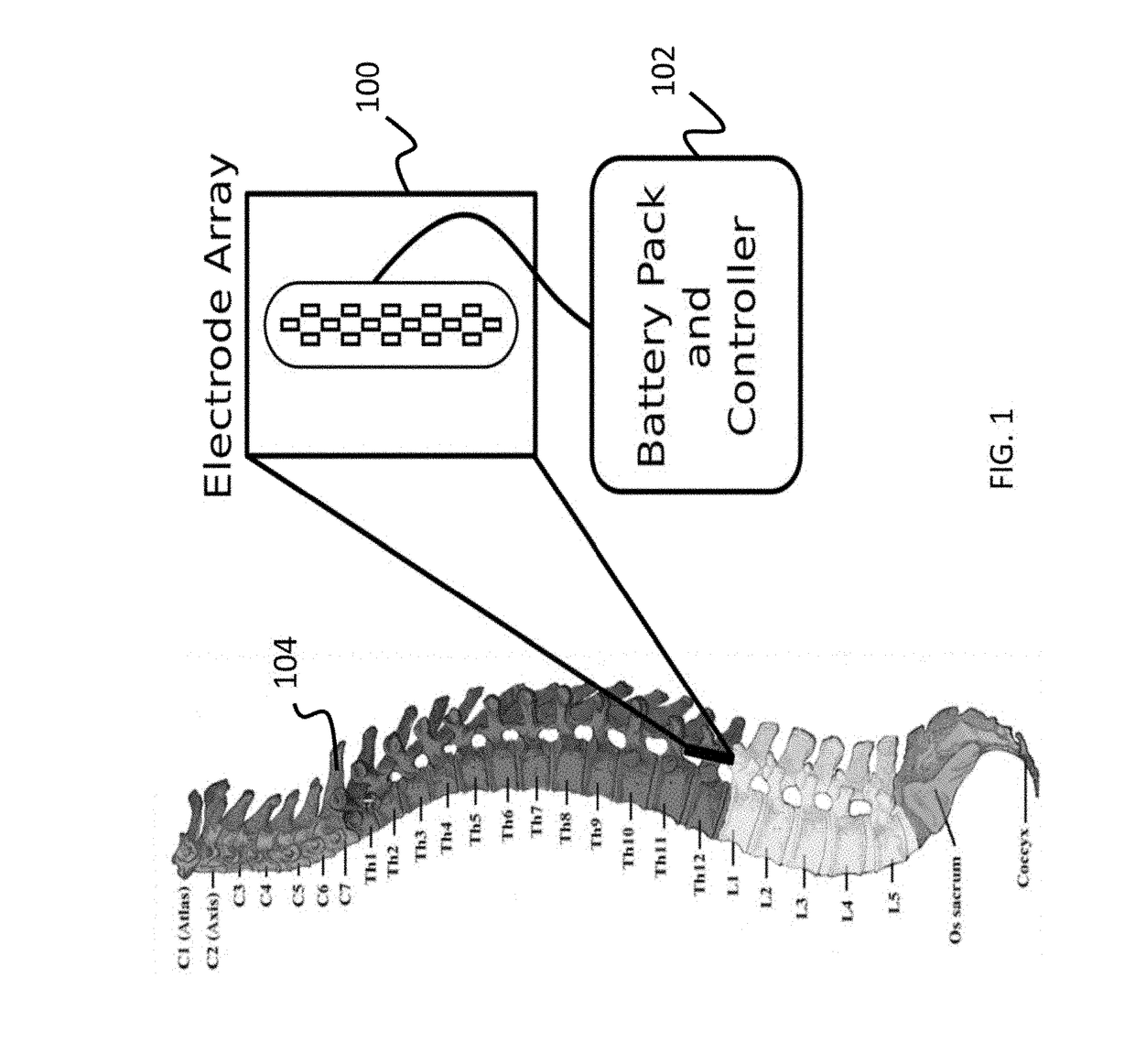 System and method for model-based estimation and control of epidural spinal cord stimulation