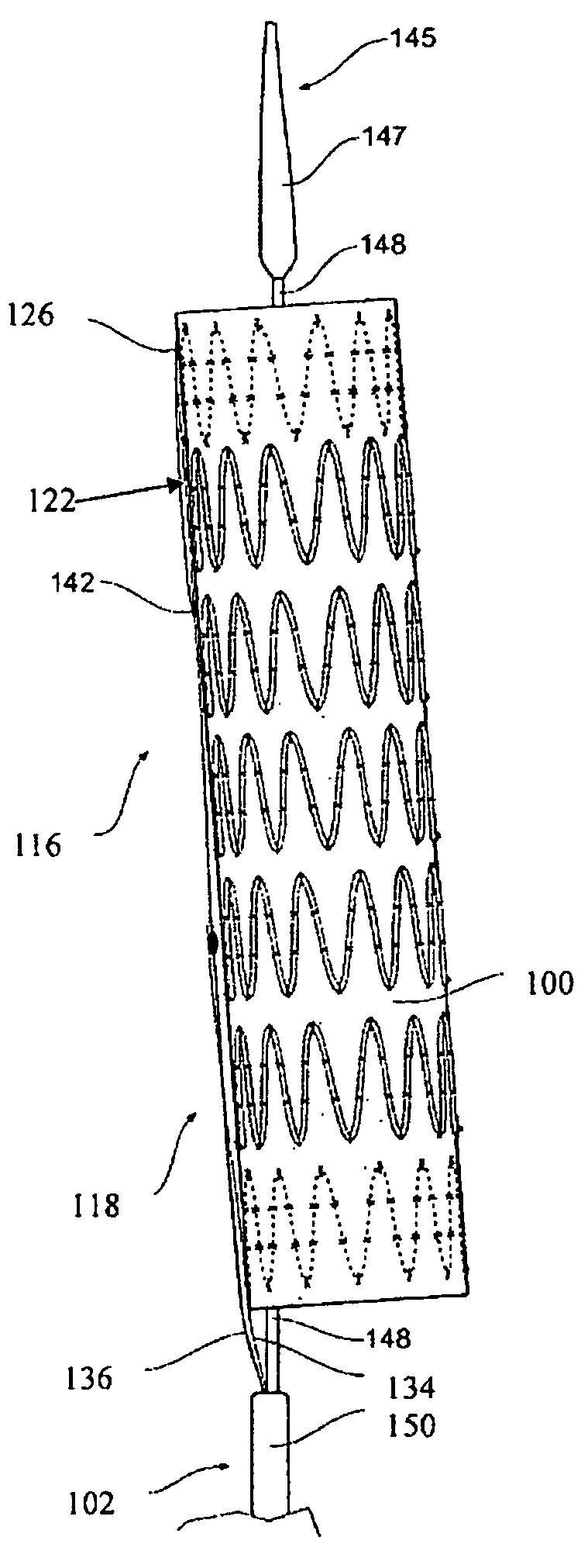 Curvable stent-graft and apparatus and fitting method