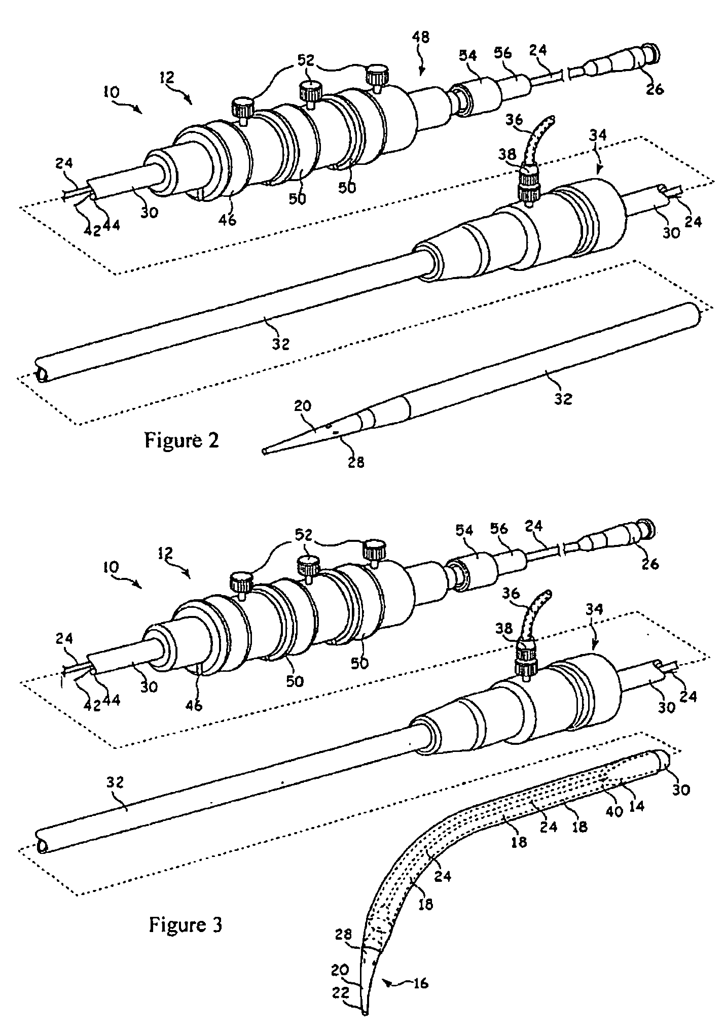 Curvable stent-graft and apparatus and fitting method