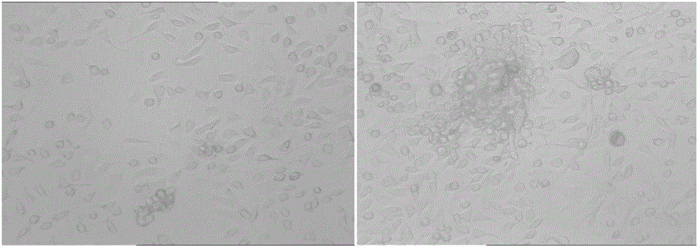 Colorectal cancer peritoneal metastasis model and establishment method thereof