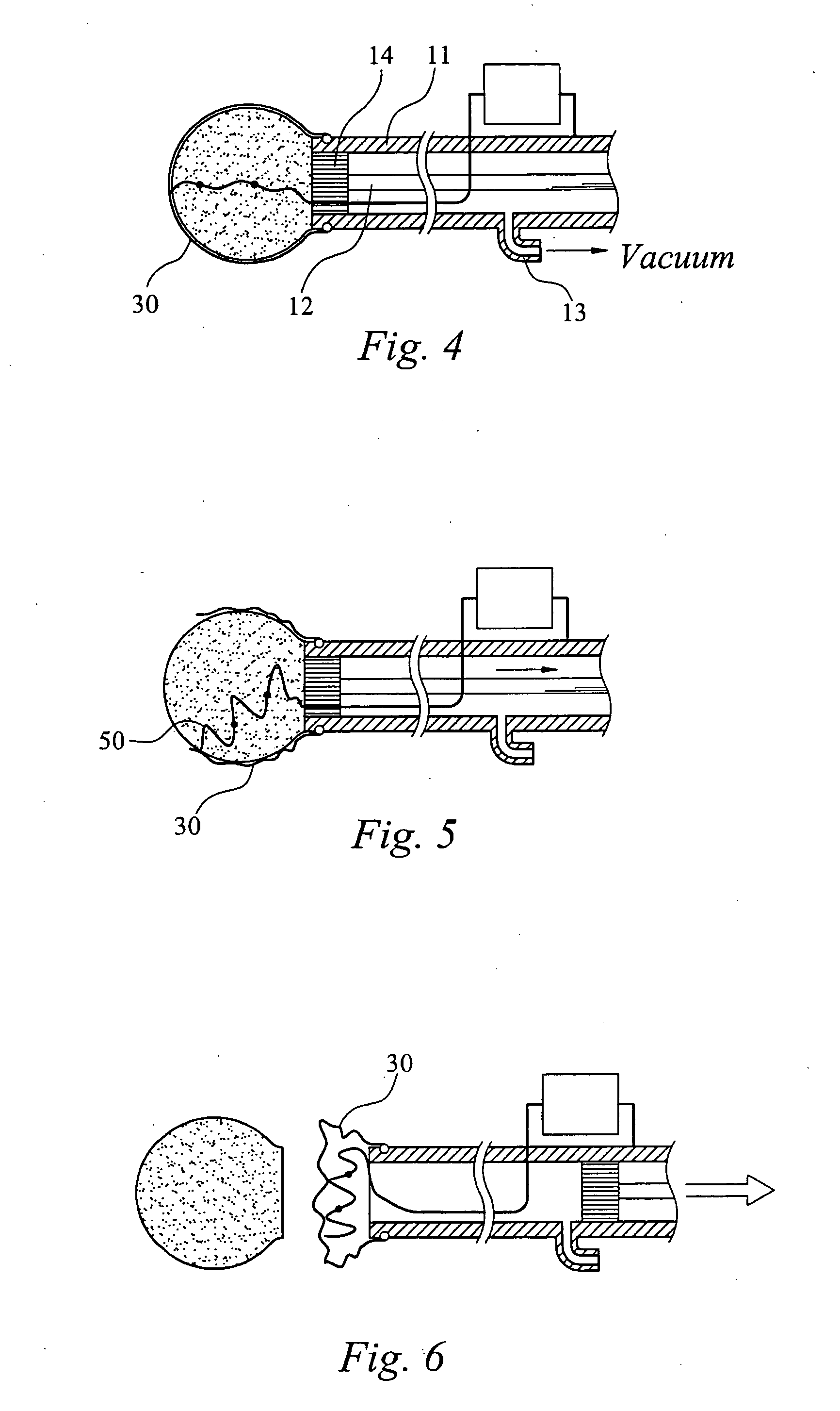 Device for forming a hardened cement in a bone cavity