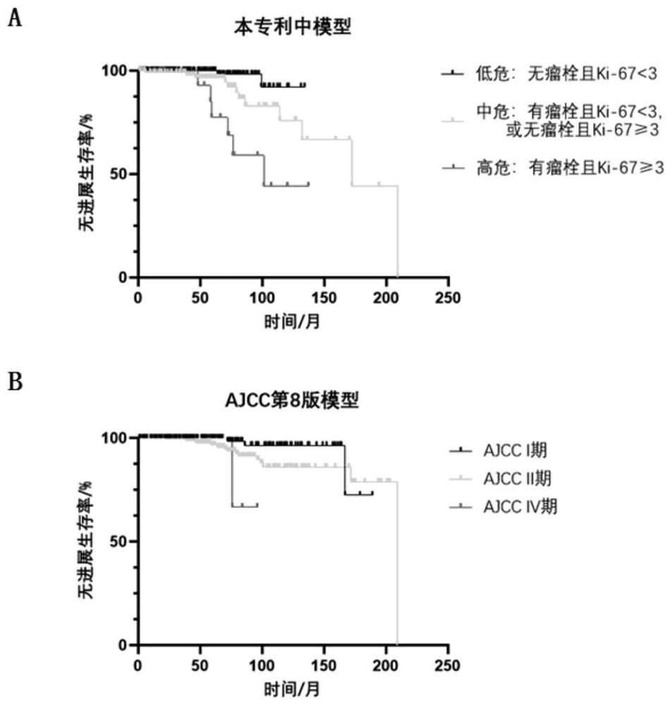System for prognosis evaluation of pancreatic solid pseudopapilloma