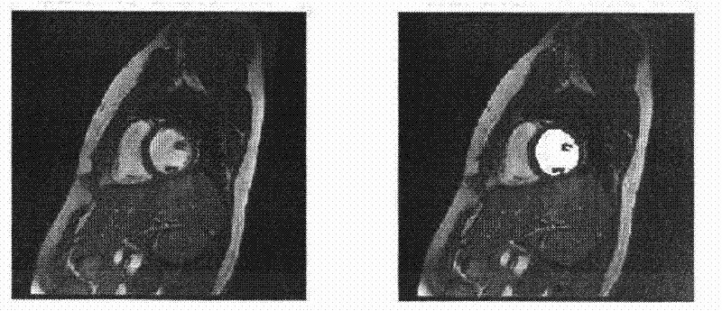 Method for fully-automatically segmenting and quantifying left ventricle of cardiac magnetic resonance image