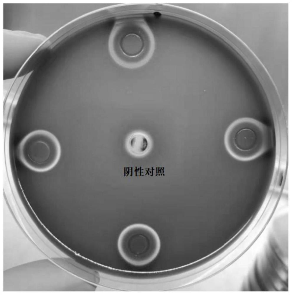 Application of bifidobacterium bifidum B11 in preparation of product for inhibiting helicobacter pylori and repairing gastric mucosal barrier