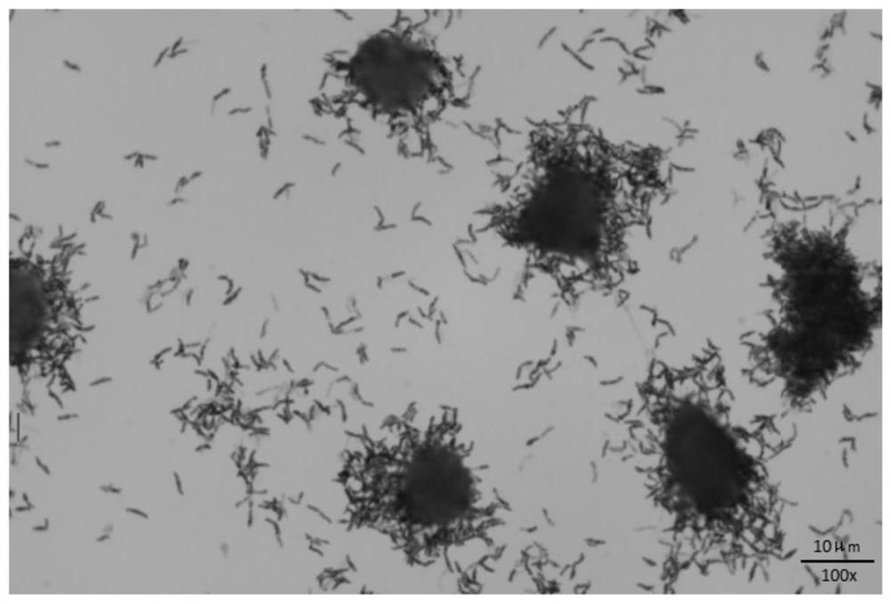 Application of bifidobacterium bifidum B11 in preparation of product for inhibiting helicobacter pylori and repairing gastric mucosal barrier