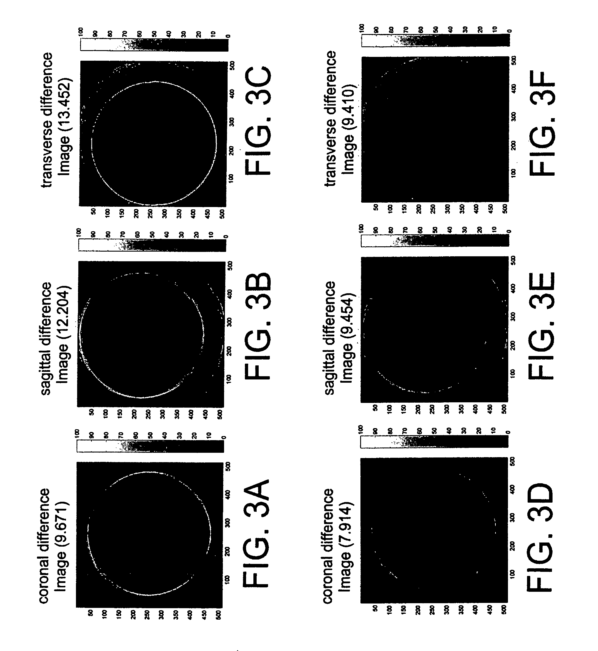K-space trajectory estimation in spiral MRI system and related method thereof