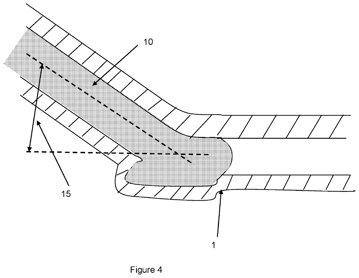 Regenerative tissue and natural tissue implants