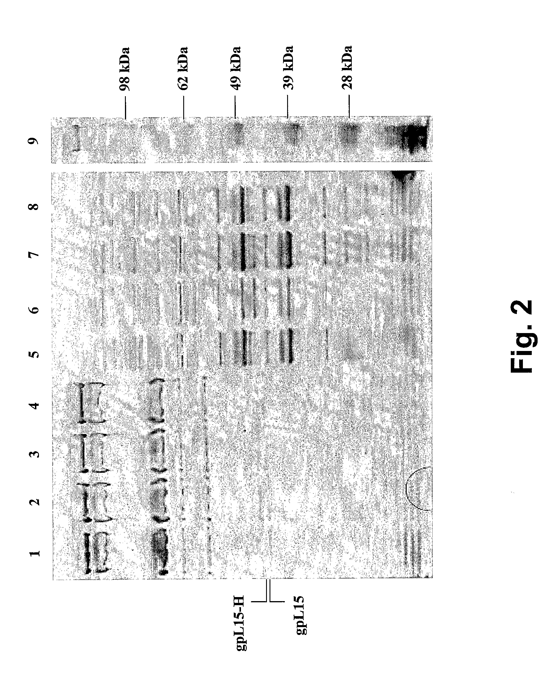 Chimeric Bacteriophages, Chimeric Phage-Like Particles, and Chimeric Phage Ghost Particles, Methods for Their Production and Use