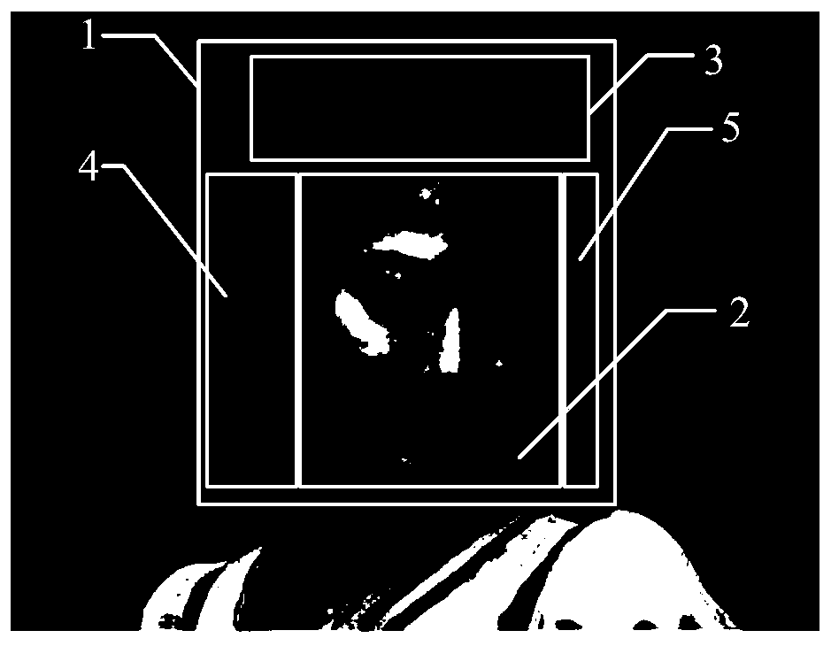 A method and mobile terminal for detecting hair distribution