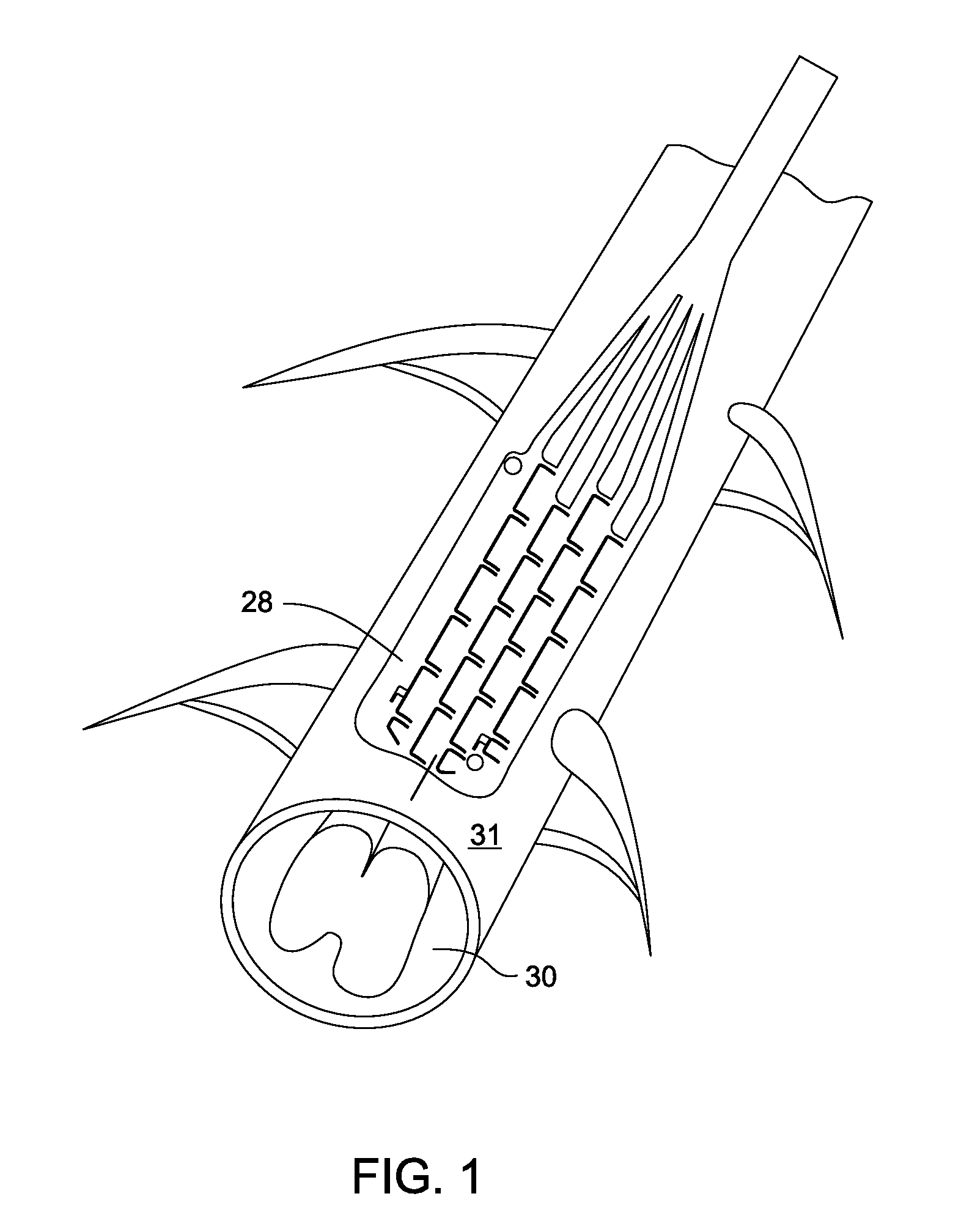 Foldable, implantable electrode assembly