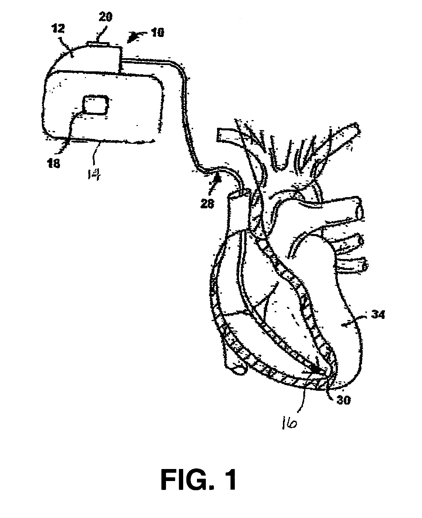 Method and apparatus to provide diagnostic index and therapy regulated by subject's autonomic nervous system