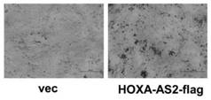 Application of long non-coding RNA-hoxa-as2 in the repair of bone tissue damage