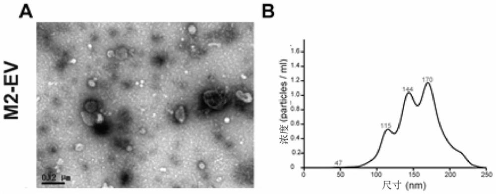 Application of M2 type macrophage exosome in preparation of medicine for treating osteoporosis