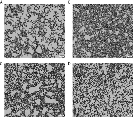 Application of aristolochic acid IVa in preparation of antihistamine or pneumonia treatment drugs