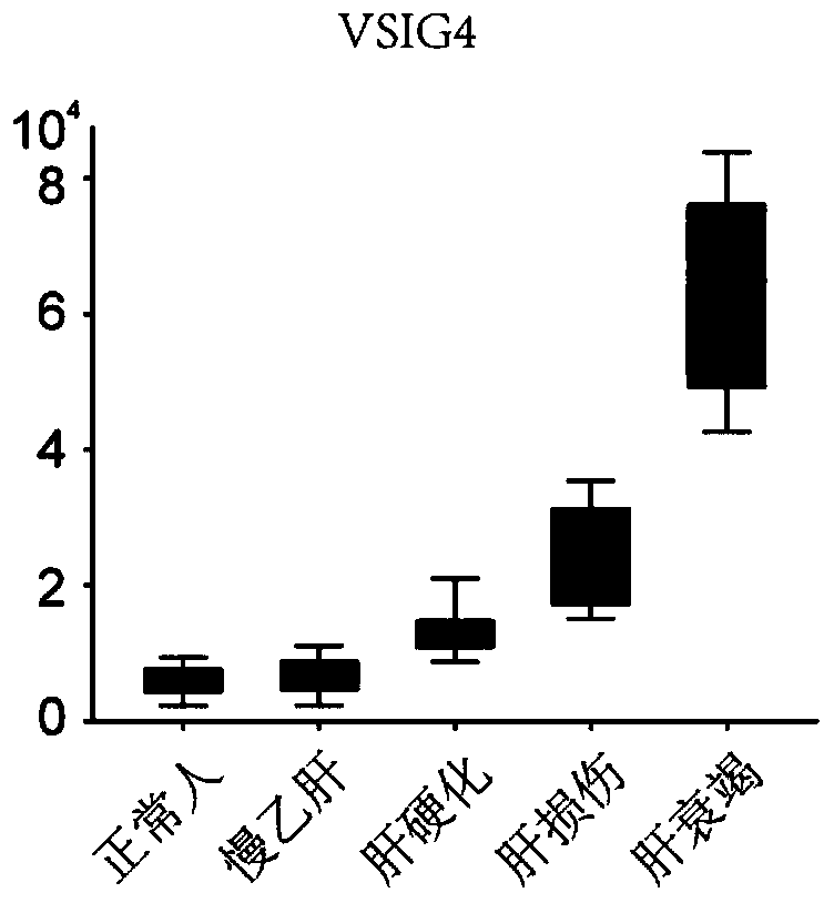 Novel application of VSIG4 in diagnosis of hepatic failure, kit and application of kit for diagnosing hepatic failure