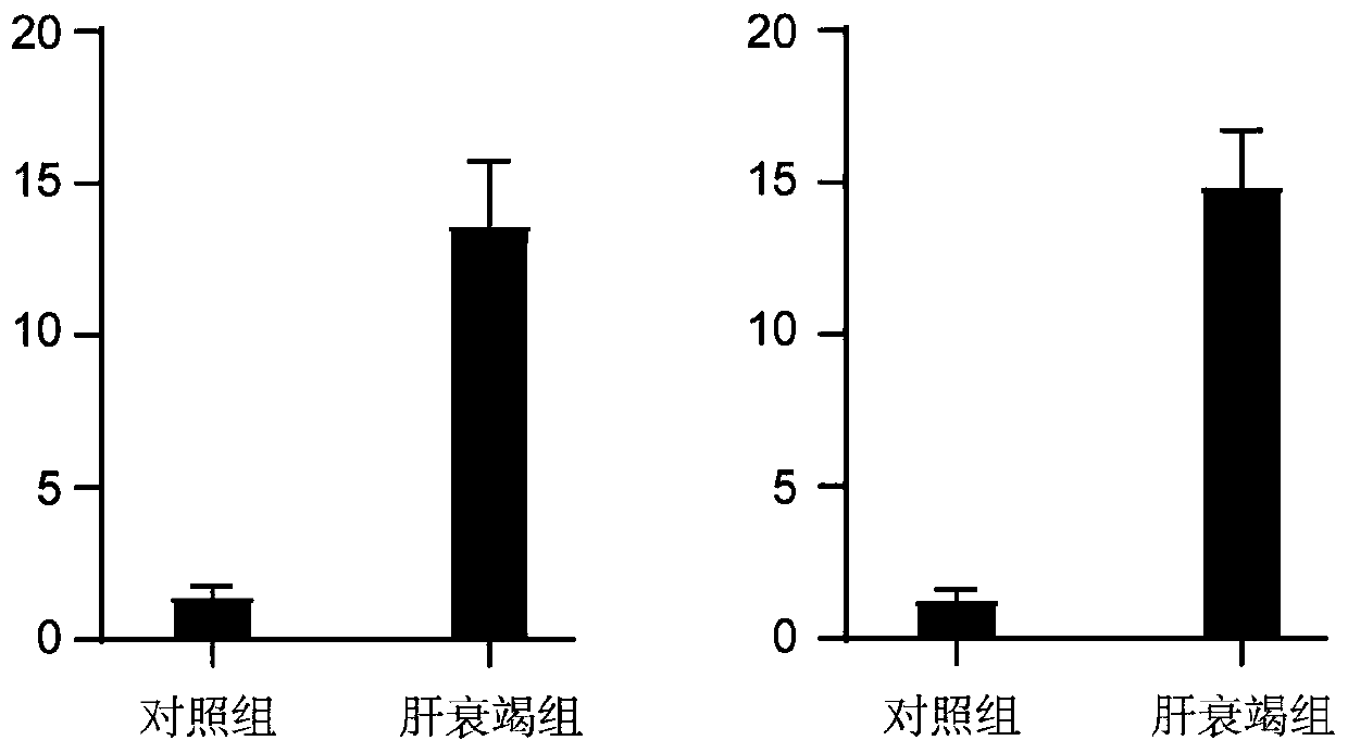 Novel application of VSIG4 in diagnosis of hepatic failure, kit and application of kit for diagnosing hepatic failure