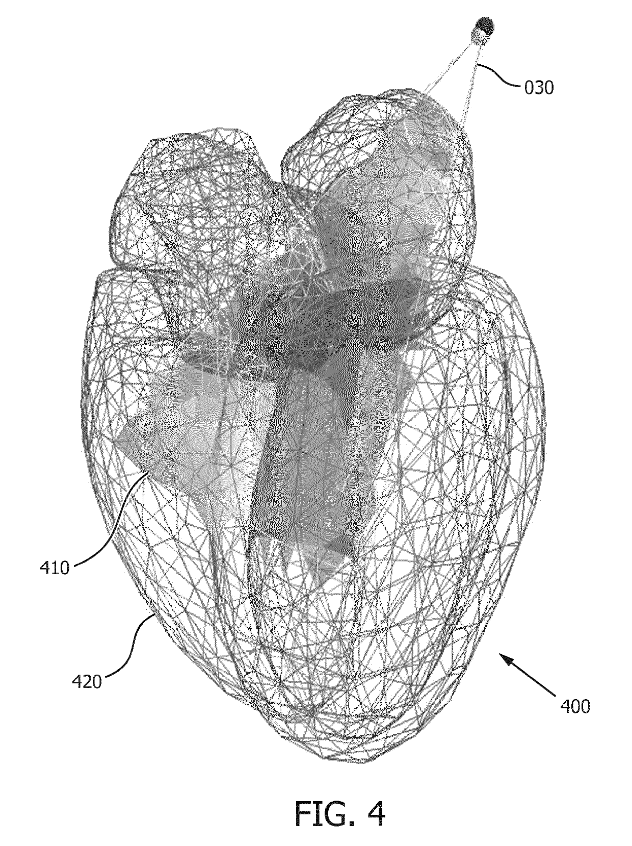 Model-based segmentation of an anatomical structure