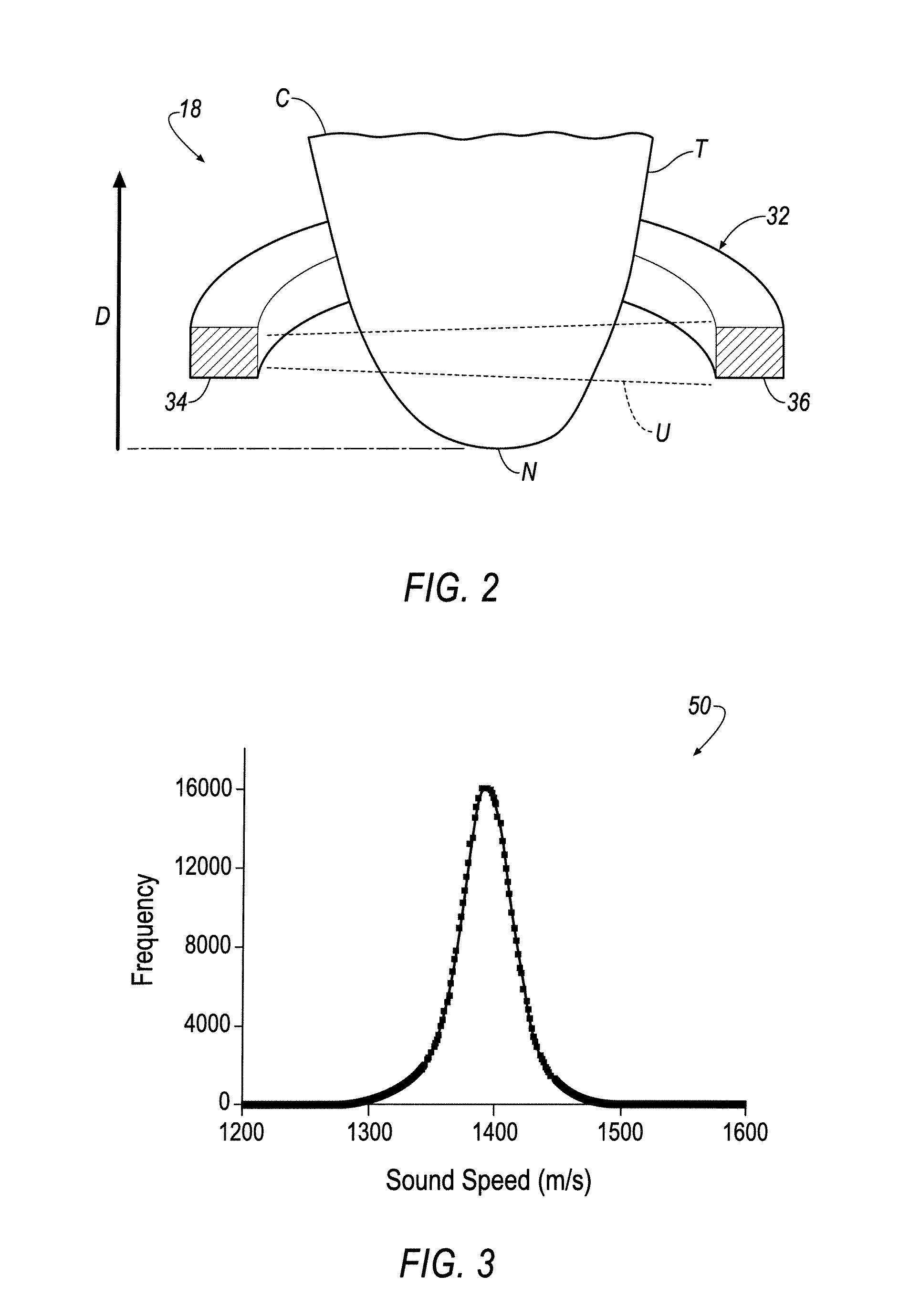 Method and Apparatus for Categorizing Breast Density and Assessing Cancer Risk Utilizing Acoustic Parameters
