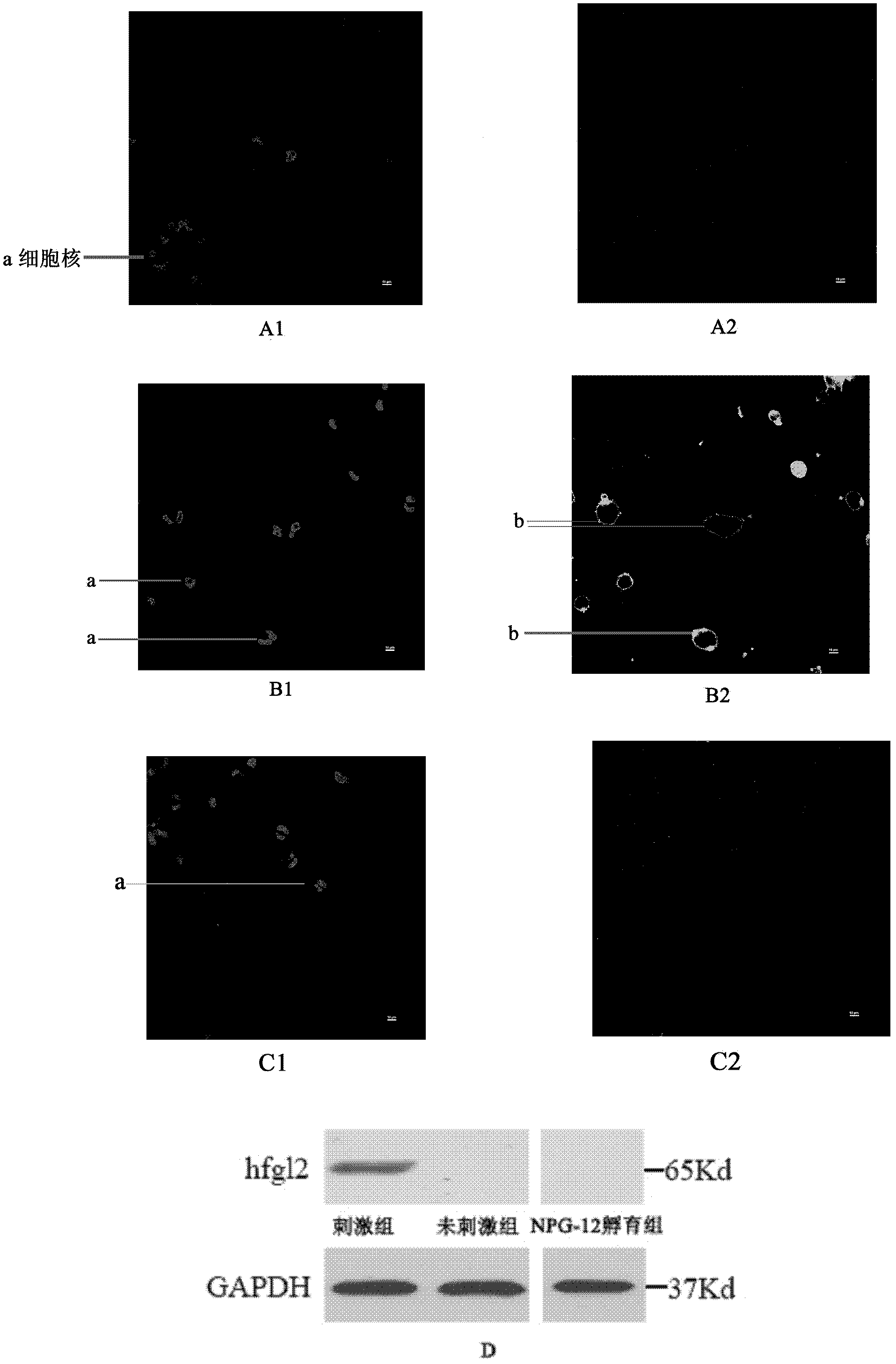 Human fibrinogen-like protein 2 prothrombinase immunogenicity peptide and use thereof