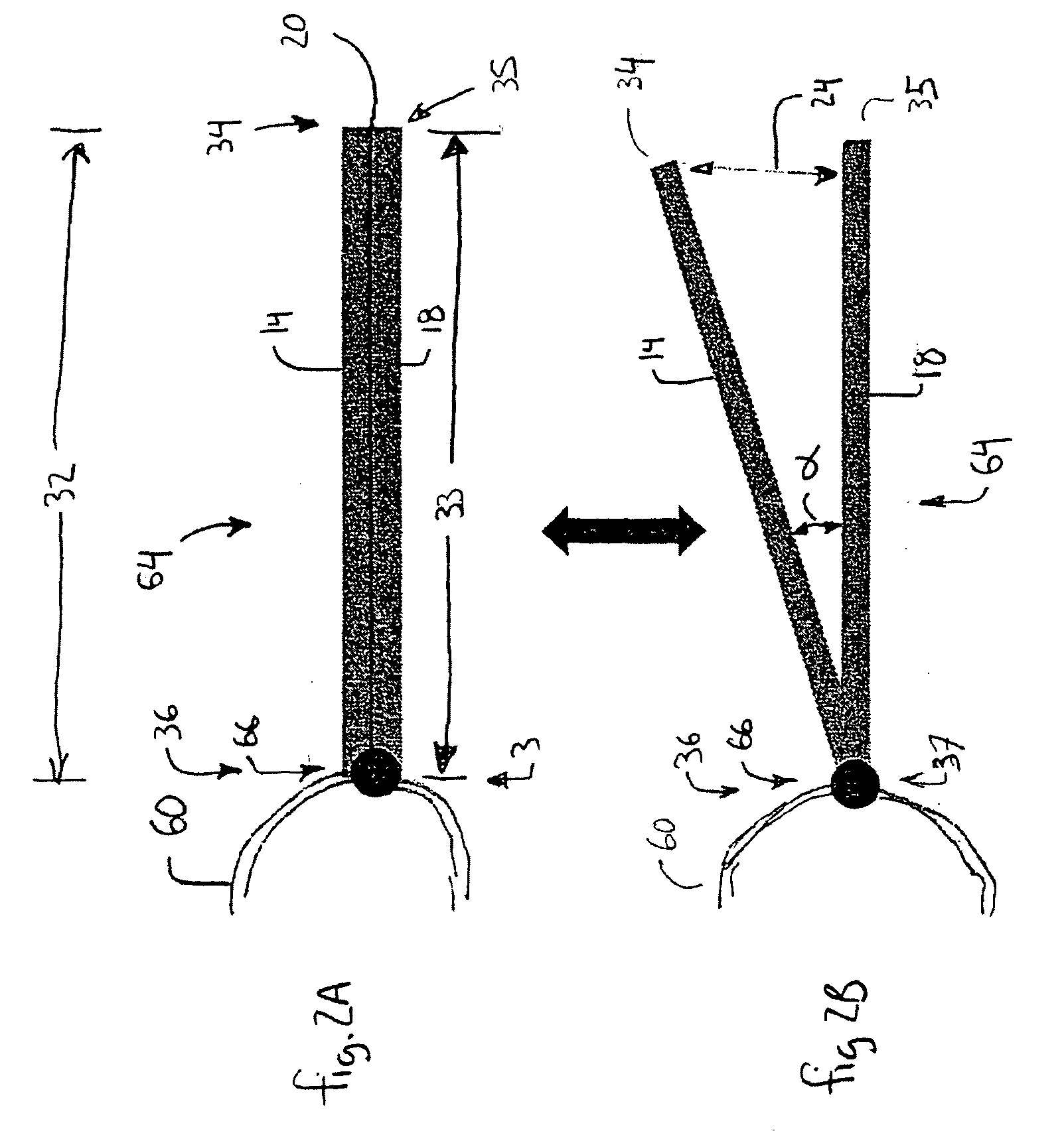 Apparatus for increase of aircraft lift and maneuverability
