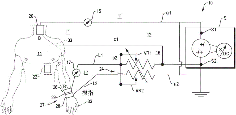 Trans-spinal direct current modulation systems