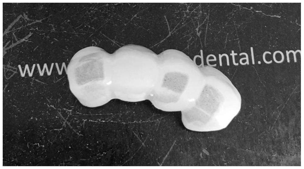 A method for digitally and precisely fabricating dental restorations