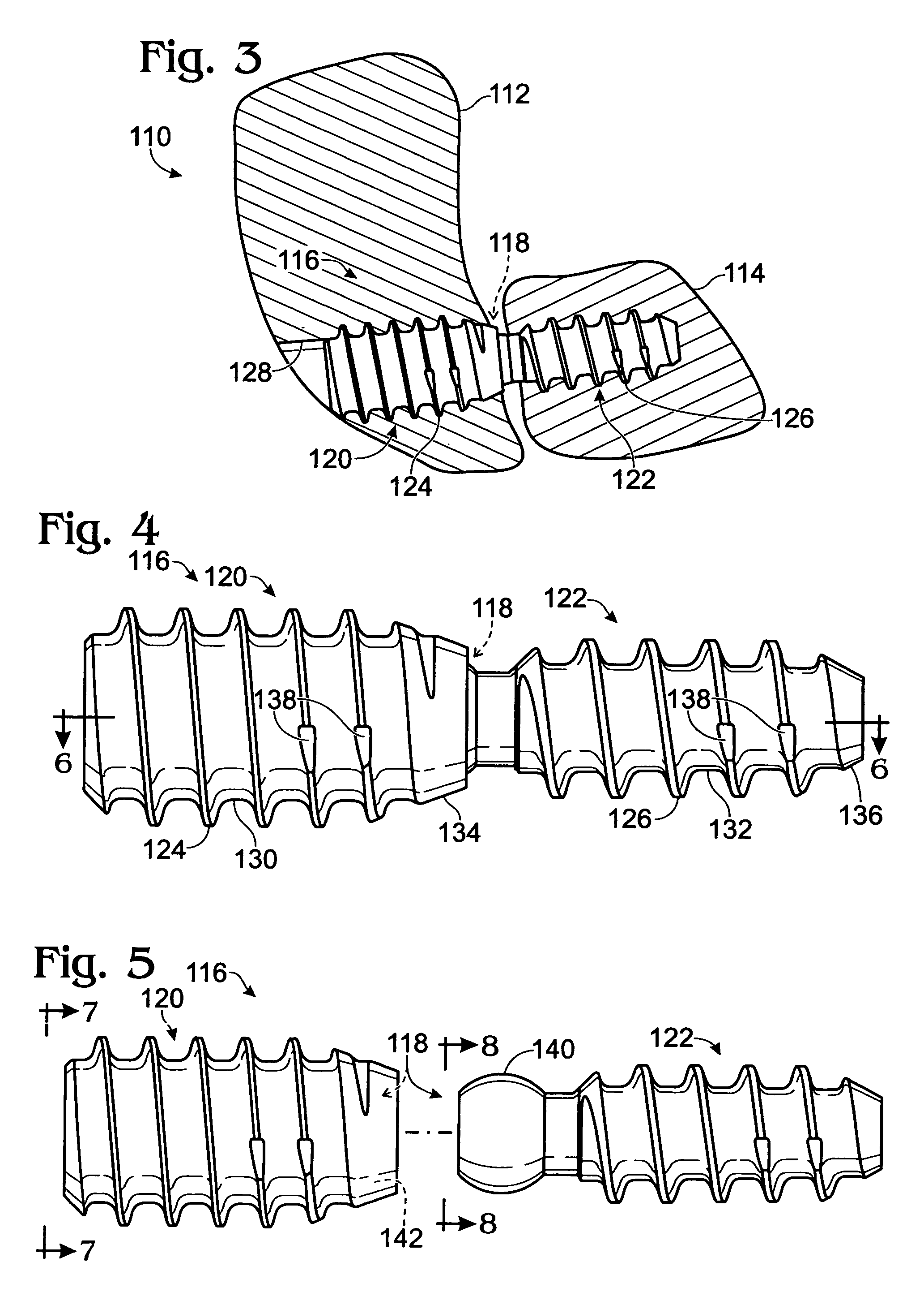 Bone connector with pivotable joint