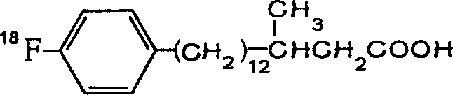 Aliphatic acid metabolic imaging agent beta-methyl-15-parafluoro [18F] phenyl-pentadecanoic acid and synthesizing method thereof