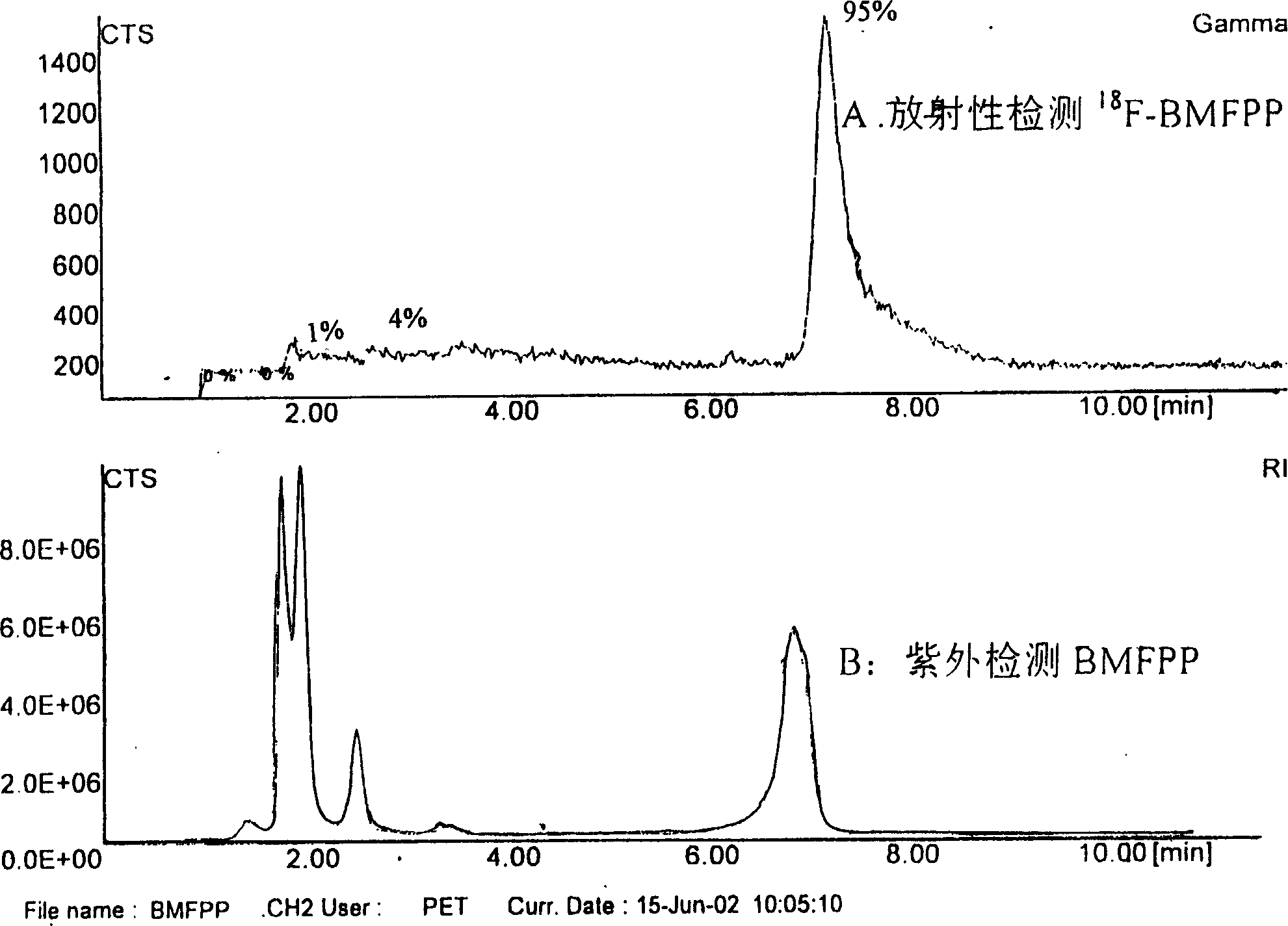 Aliphatic acid metabolic imaging agent beta-methyl-15-parafluoro [18F] phenyl-pentadecanoic acid and synthesizing method thereof