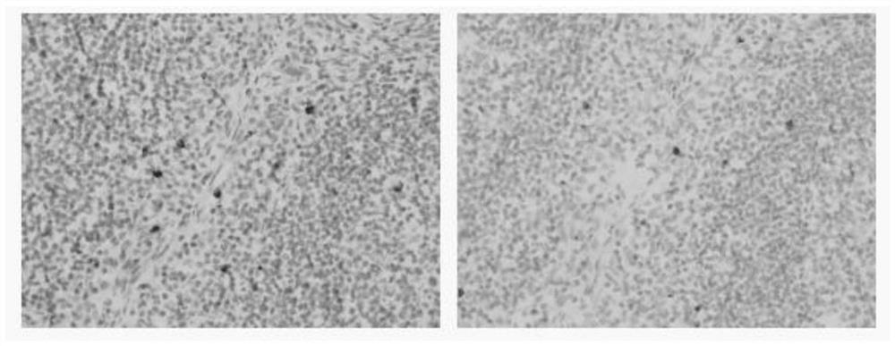 Anti-LAG3 protein monoclonal antibody and cell strain, preparation method and application thereof