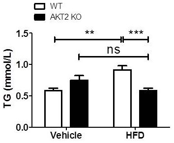 Application of AKT2 inhibitor in preparation of medicine for treating non-alcoholic fatty liver disease