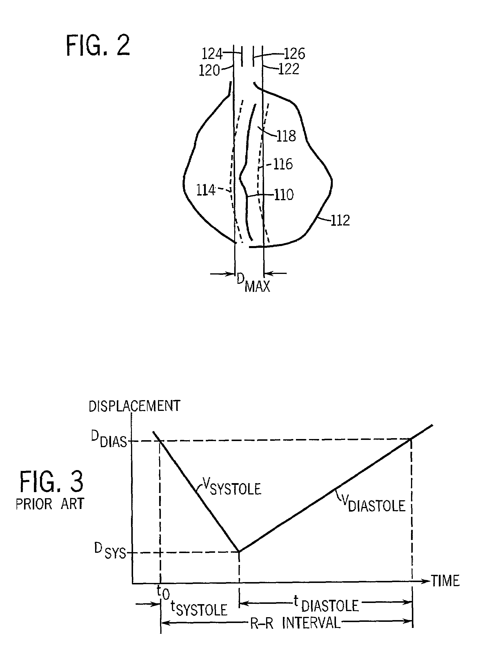 Method and apparatus for automated tracking of non-linear vessel movement using MR imaging