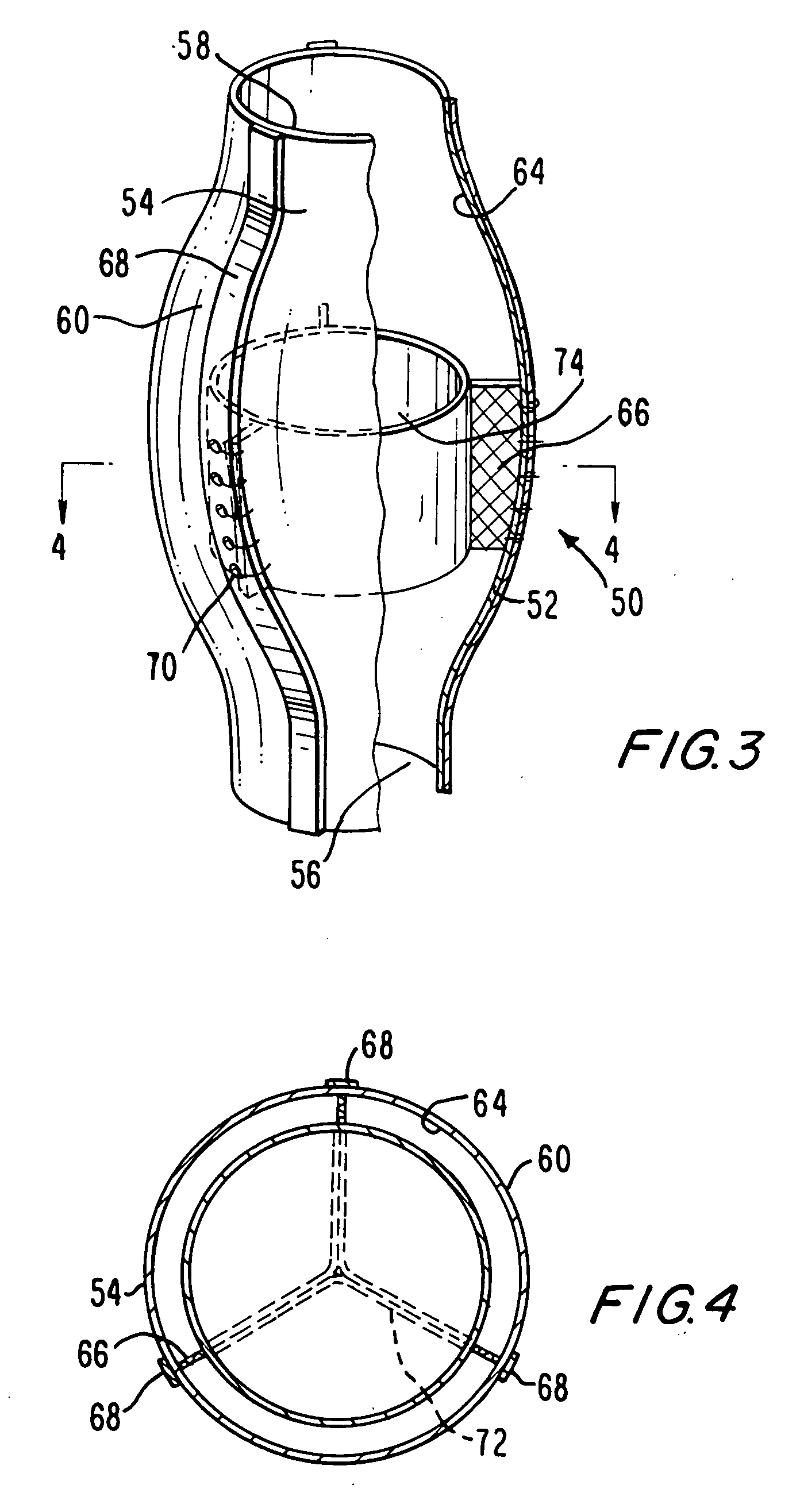 Implantable prosthetic valve with non-laminar flow