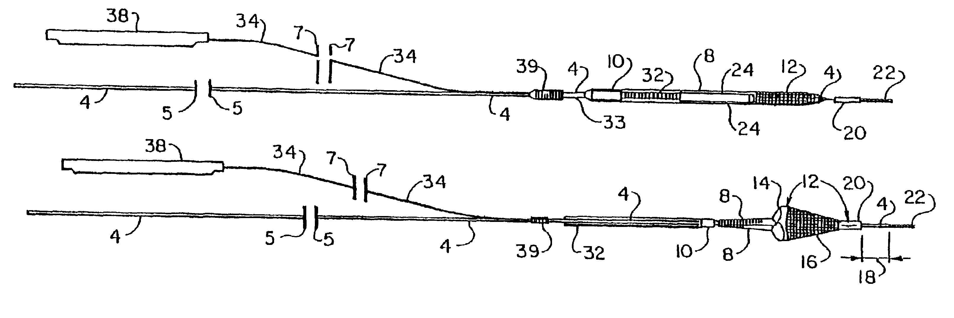 Apparatus for capturing objects beyond an operative site utilizing a capture device delivered on a medical guide wire