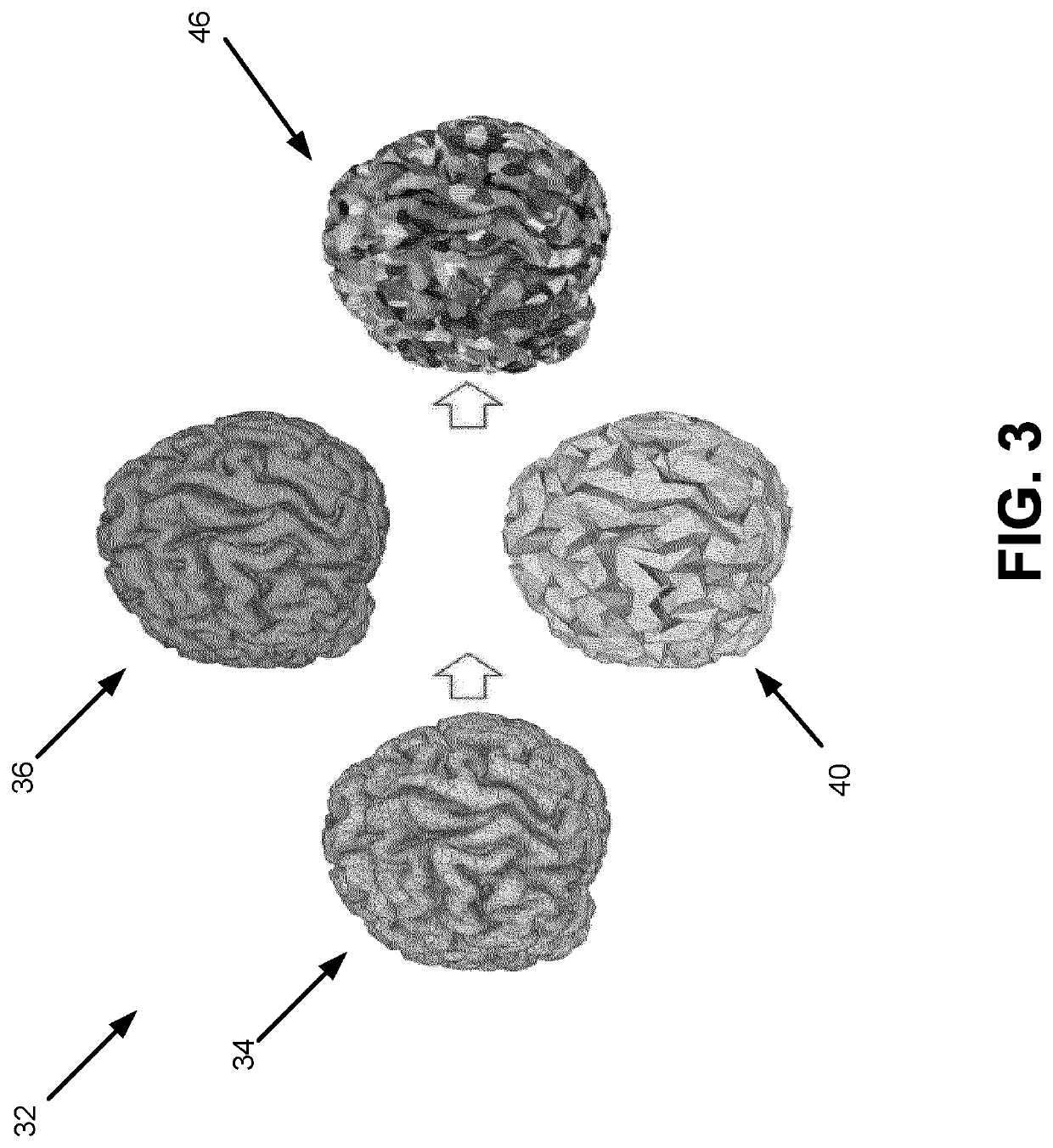 Patient-specific cortical surface tessellation into dipole patches