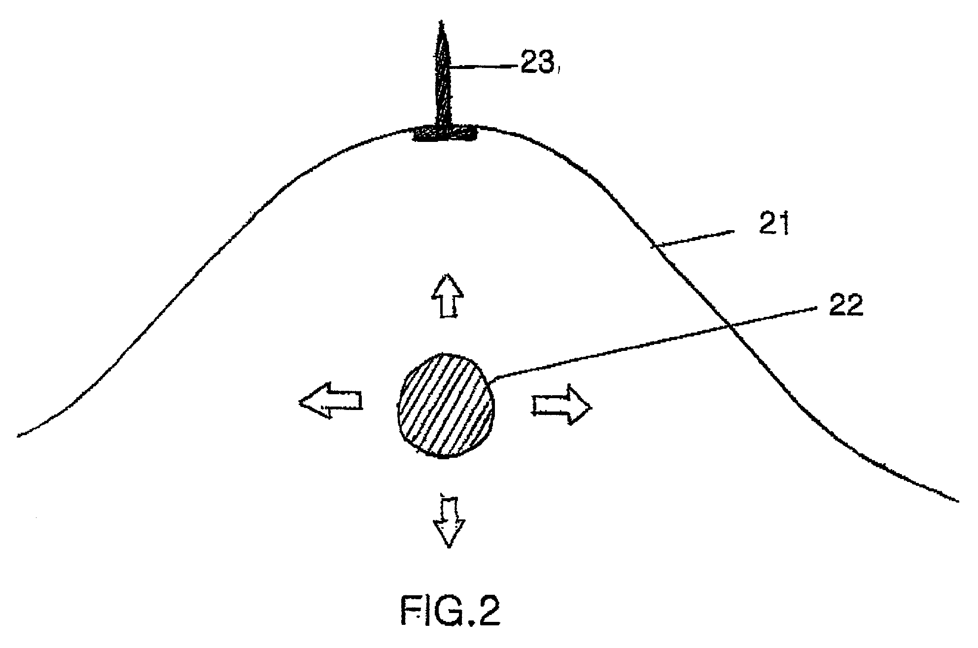 Surgical instruments and method for creating anatomic working space in minilaparotomy procedure