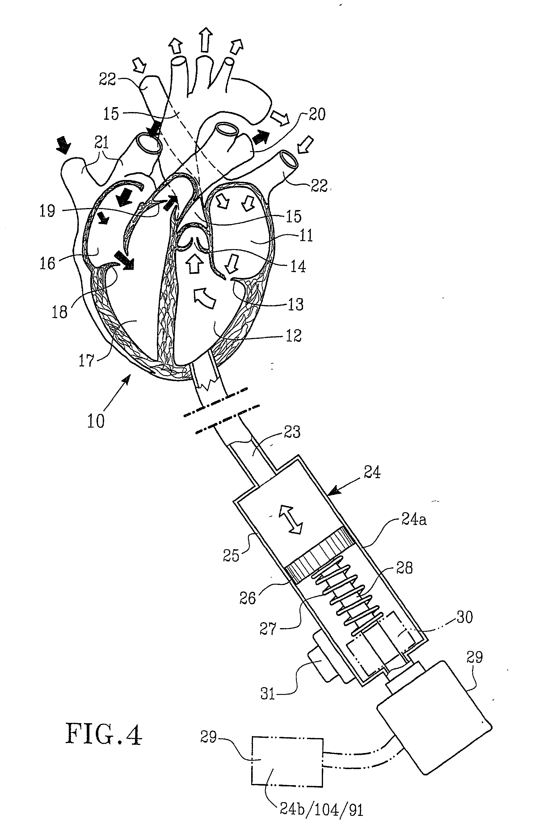 Implantable device for utilisation of the hydraulic energy of the heart
