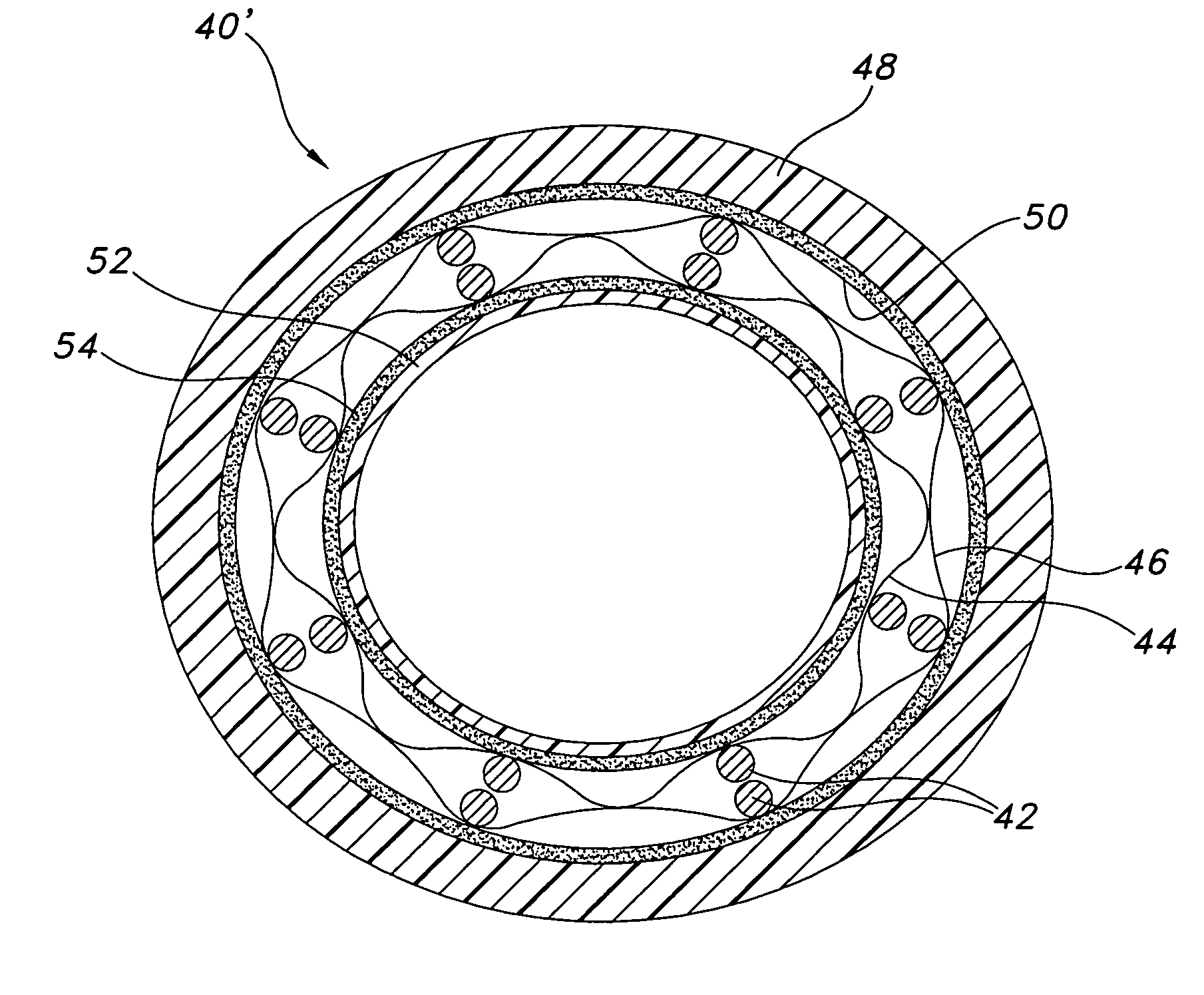 Pressure lamination method for forming composite ePTFE/textile and ePTFE/stent/textile prostheses
