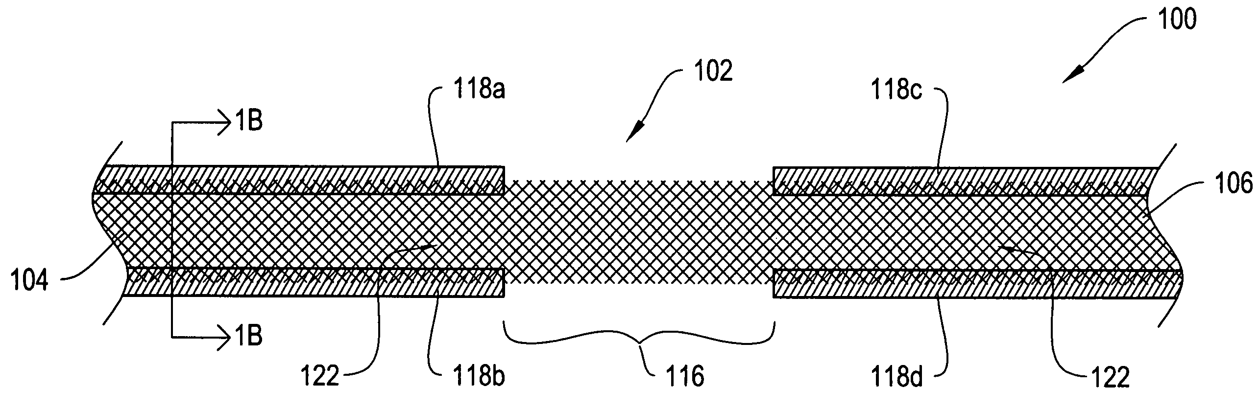 Dissolvable protective treatment for an implantable supportive sling