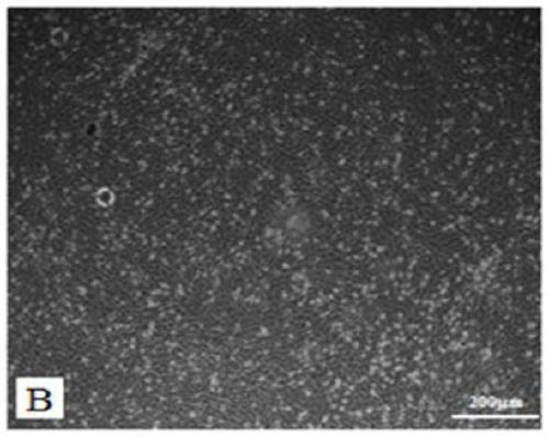 Construction method of radioactive cell damage model