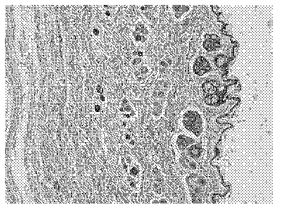 Nanometer ginkgo leaf extract external preparation and application thereof