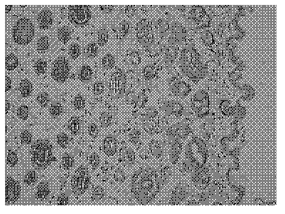 Nanometer ginkgo leaf extract external preparation and application thereof