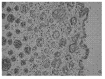 Nanometer ginkgo leaf extract external preparation and application thereof