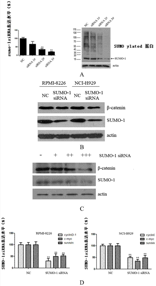 A kind of anti-multiple myeloma small interfering ribonucleic acid and its application